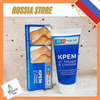 Kem nứt gót chân kpem nga 50ml