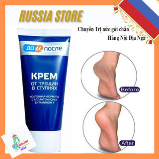 Kem nứt gót chân kpem nga 50ml