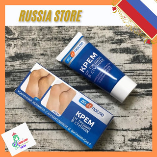 Kem nứt gót chân kpem nga 50ml