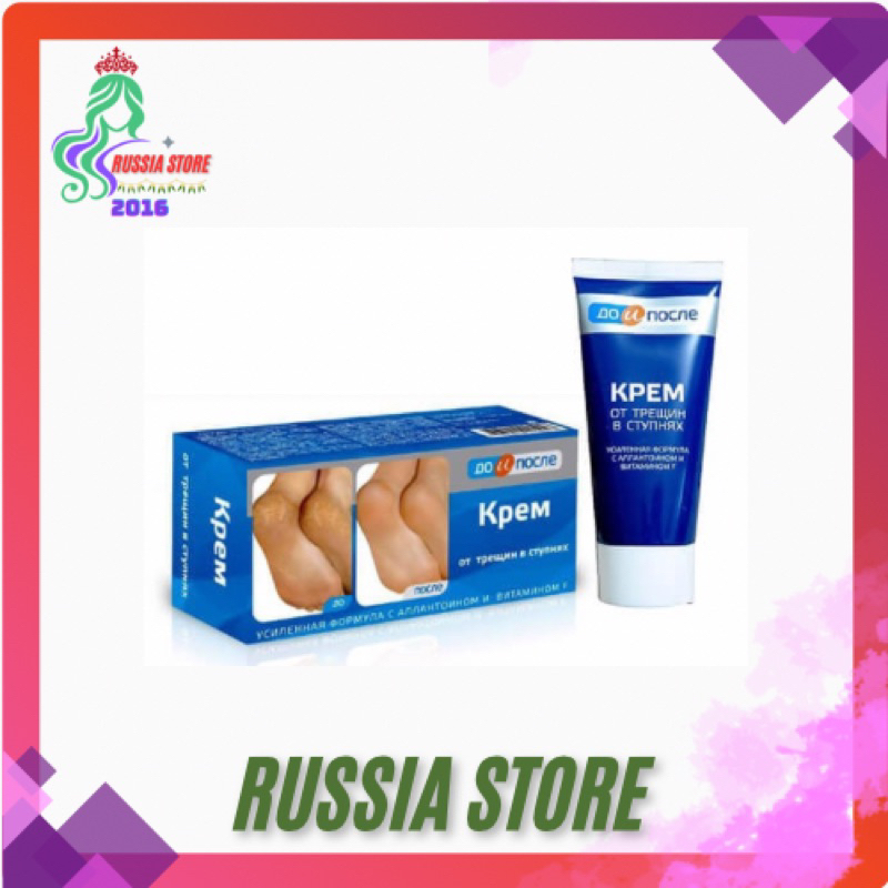 Kem nứt gót chân kpem nga 50ml