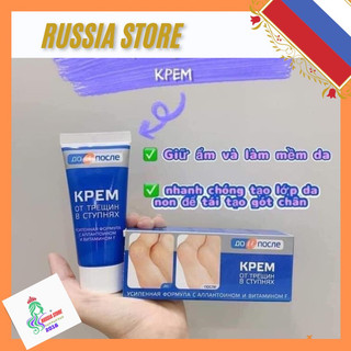 Kem nứt gót chân kpem nga 50ml