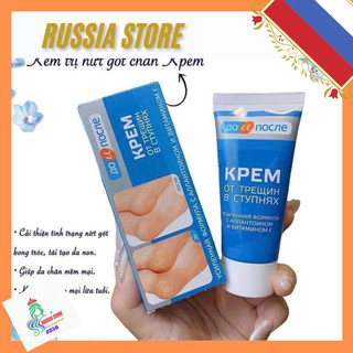Kem nứt gót chân kpem nga 50ml