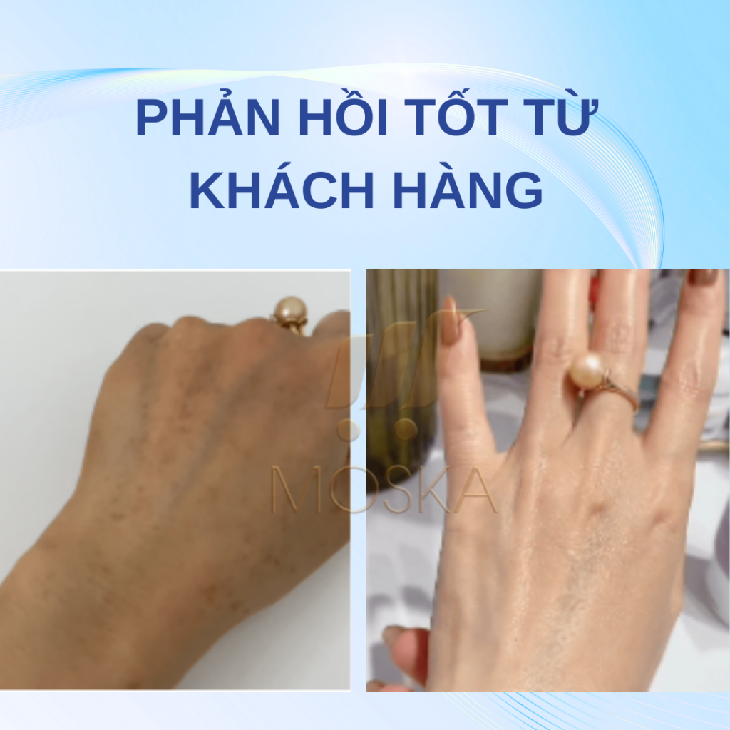 Kem Dưỡng Da Tay VHA Mờ Nám Tàn Nhang Đồi Mồi VHA  Kem VHA Dưỡng Da Tay Mềm Mịn Trắng Sáng