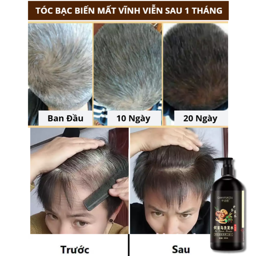 Dầu Gội Phủ Bạc QIANYUKOU - Giảm bạc tóc, cải thiện nấm ngứa da đầu, QIANYUKOU chiết suất thiên nhiên, 350ml - QUINN