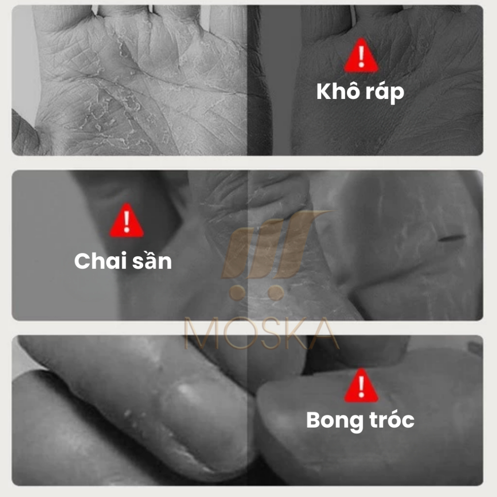 Kem dưỡng tay Đông Y Golden Snake dưỡng da tay siêu cấp ẩm chống lão hóa ngừa nhăn cho đôi tay đẹp hộp 110g | Moska Shop