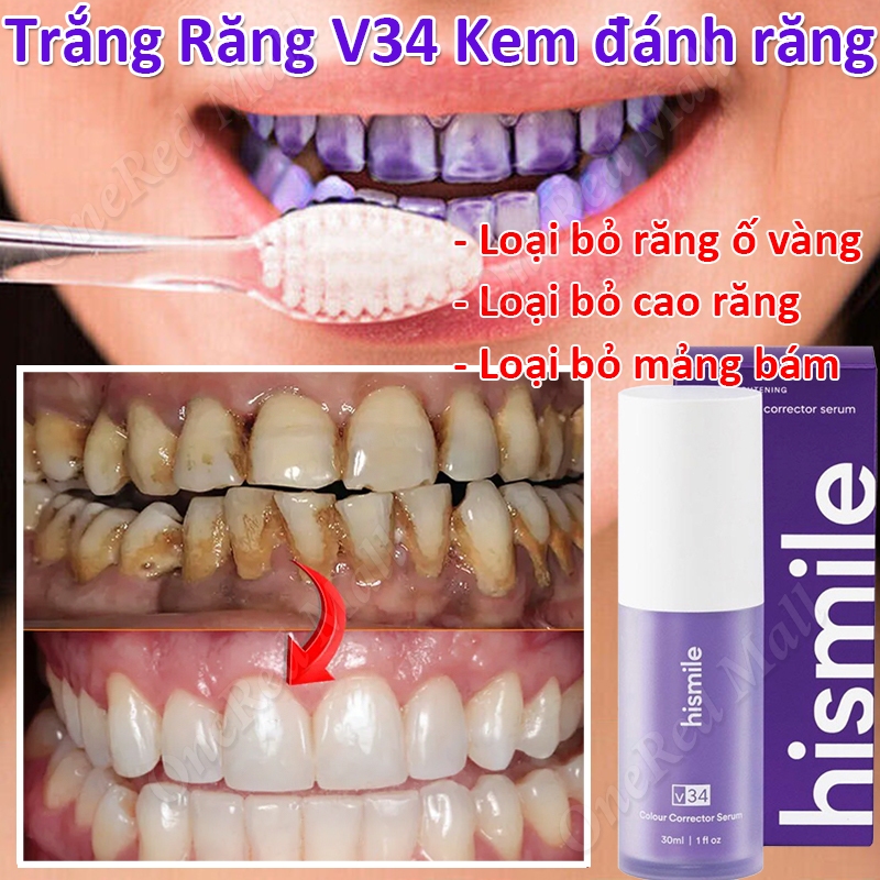 Serum Trắng Răng V34 Kem đánh răng trắng răng Loại Bỏ Cao Răng Làm Trắng Răng Tẩy ố Vàng tẩy trắng r