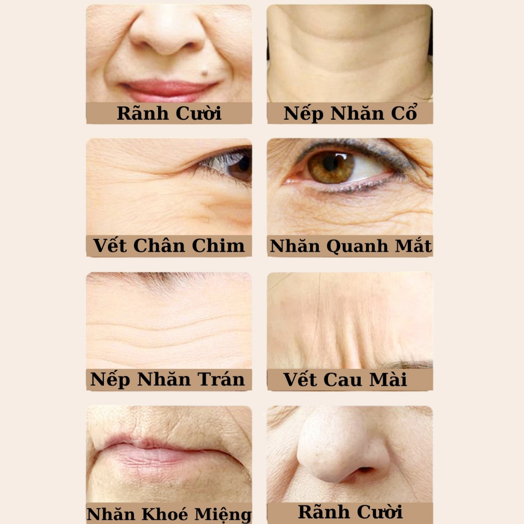 Kem Dưỡng Da Bổ Sung Dưỡng Chất Xoá Mờ Nếp Nhăn Hiệu Quả, Kem Dưỡng Ngăn Ngừa Nhăn Da Hỗ Trợ Tái Tạo Da