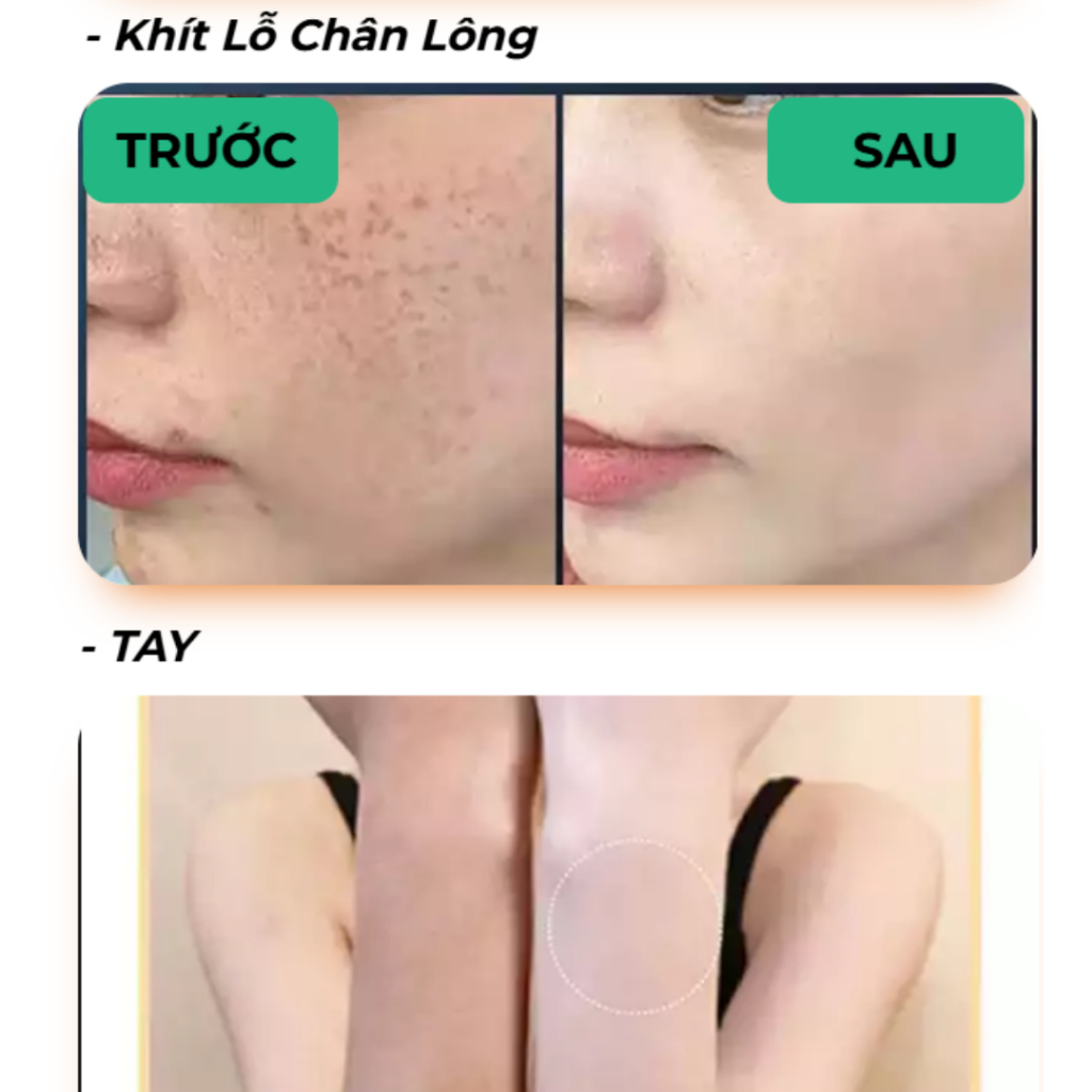 Sữa ong chúa kết hợp tắm và rửa mặt YAZHI HUANAN SANJIN - Giúp se khít lỗ chân lông, sạch mụn bã nhờn, giúp da hồng hào