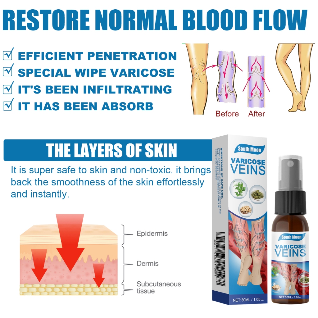 South Moon  Xịt chăm sóc chân giảm khó chịu cải thiện giãn tĩnh mạch và thúc đẩy tuần hoàn máu