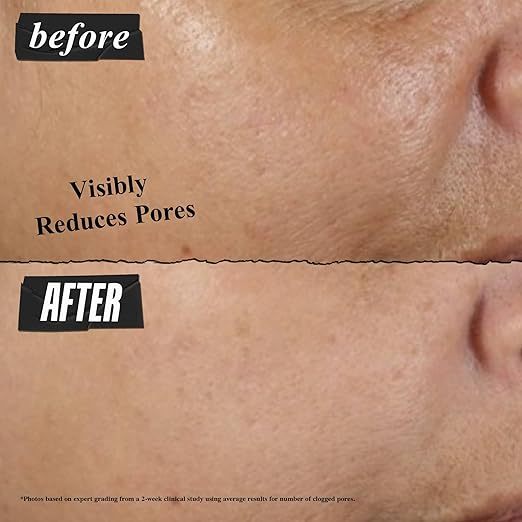 Mặt Nạ Đất Sét Kiehl's Làm Sạch Lỗ Chân Lông Kiehl's Rare Earth Deep Pore Cleansing Masque 125ml