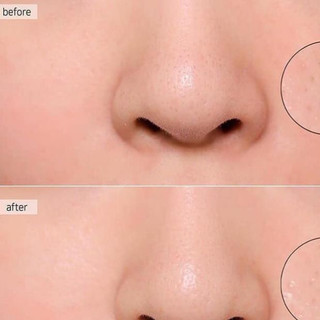 Nước thần EL Micro Essence Minisize 15ml - 30ml