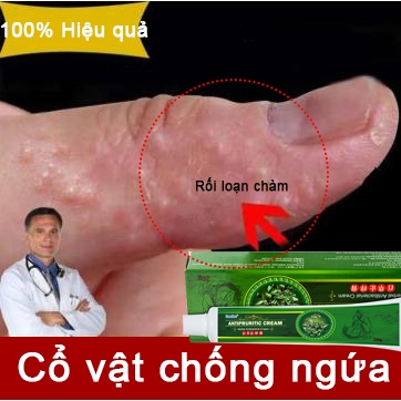 Kem chống ngứa, 20g, kem kháng khuẩn, kem dưỡng da thảo dược, kem kháng khuẩn, kem chống ngứa da