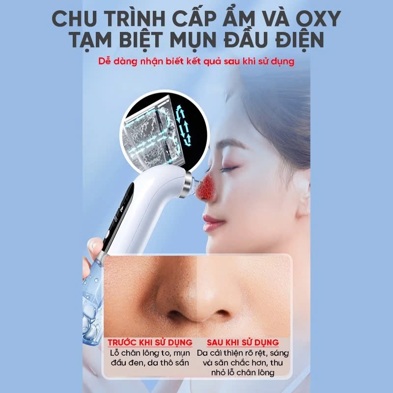 Máy hút mụn cao cấp kèm 6 đầu hút, máy hút mụn cầm tay hút sạch mụn đầu đen, mụn cám, bã nhờn sử dụng pin sạc tiện lợi | BigBuy360 - bigbuy360.vn
