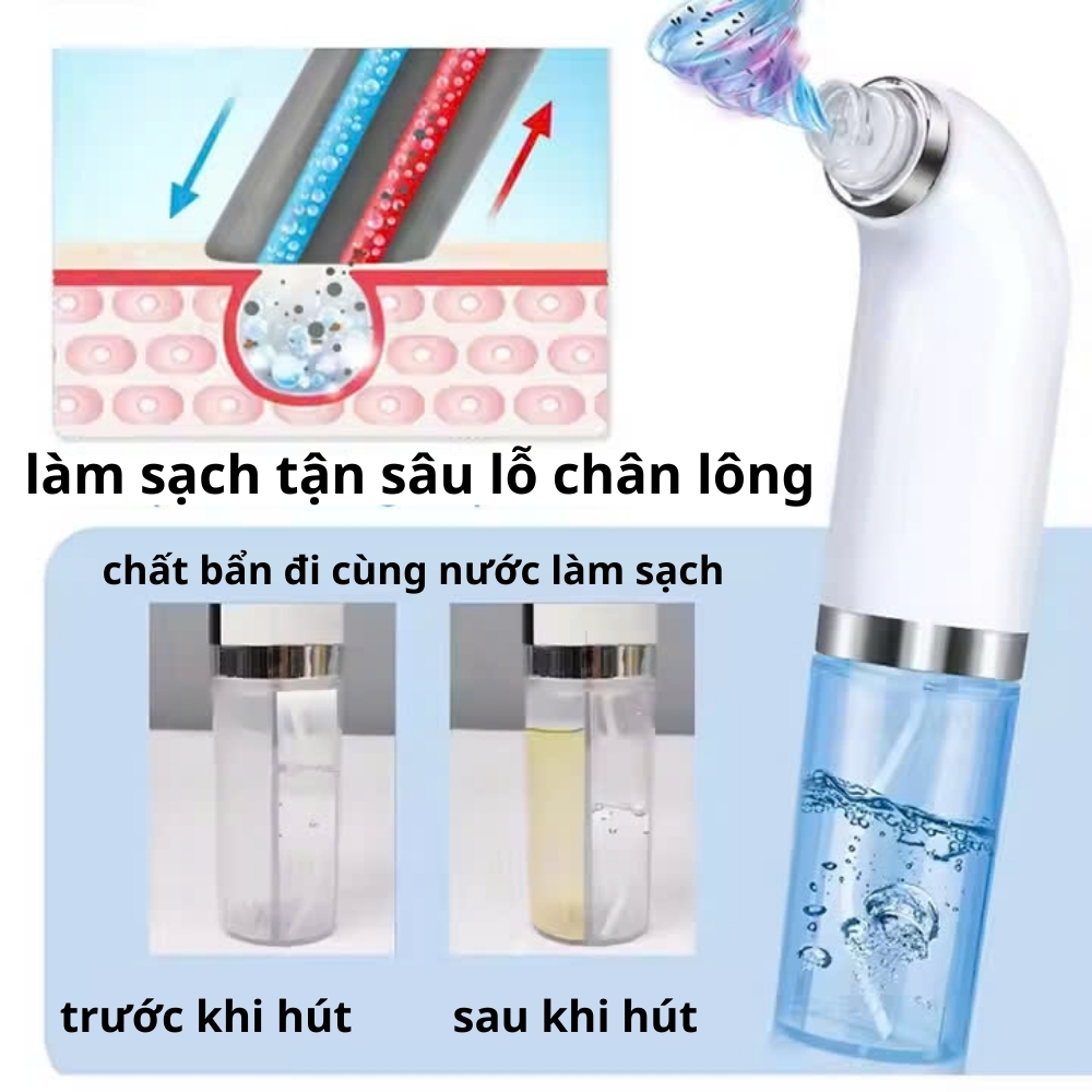 Máy hút mụn cao cấp kèm 6 đầu hút, máy hút mụn cầm tay hút sạch mụn đầu đen, mụn cám, bã nhờn sử dụng pin sạc tiện lợi | BigBuy360 - bigbuy360.vn