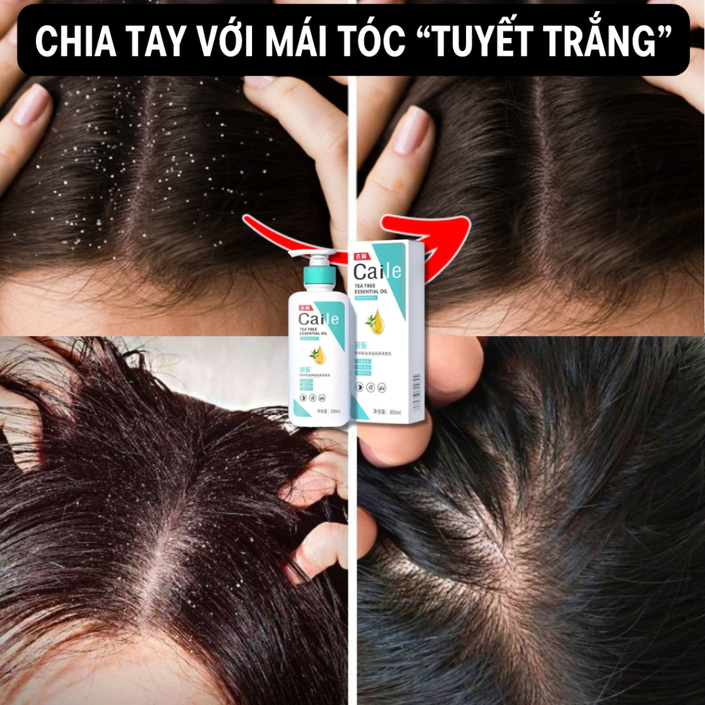 Dầu gội thảo dược CAILE - Dầu gội giúp xua tan gàu, v.i.ê.m da đầu, cho mái tóc đen mượt mà, hương thơm lan tỏa trên tóc
