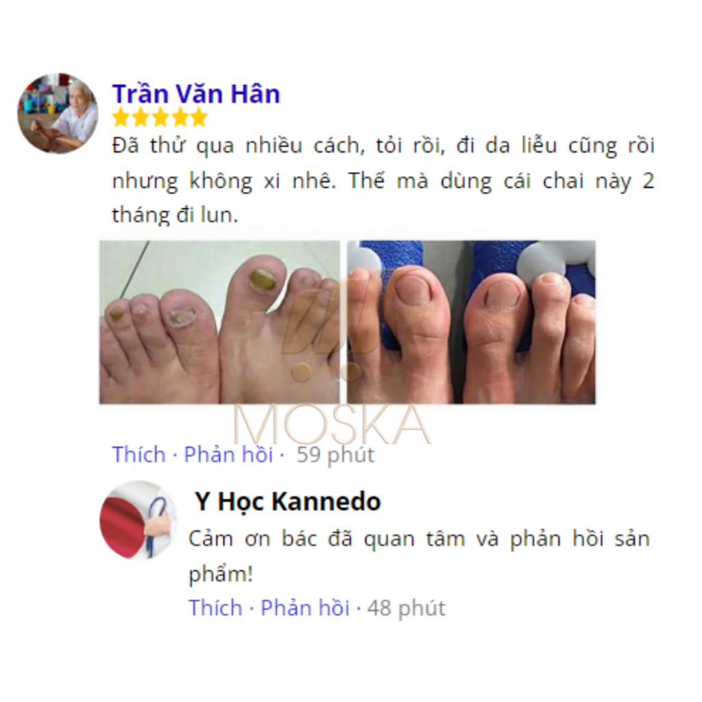 Tinh Chất Nấm Móng Tay Chân Kannedo Nhật Bản 30ML Giảm Nấm Móng, Hỗ Trợ Giảm Hư Móng, Dưỡng Móng Dày Và Khỏe| Moska shop