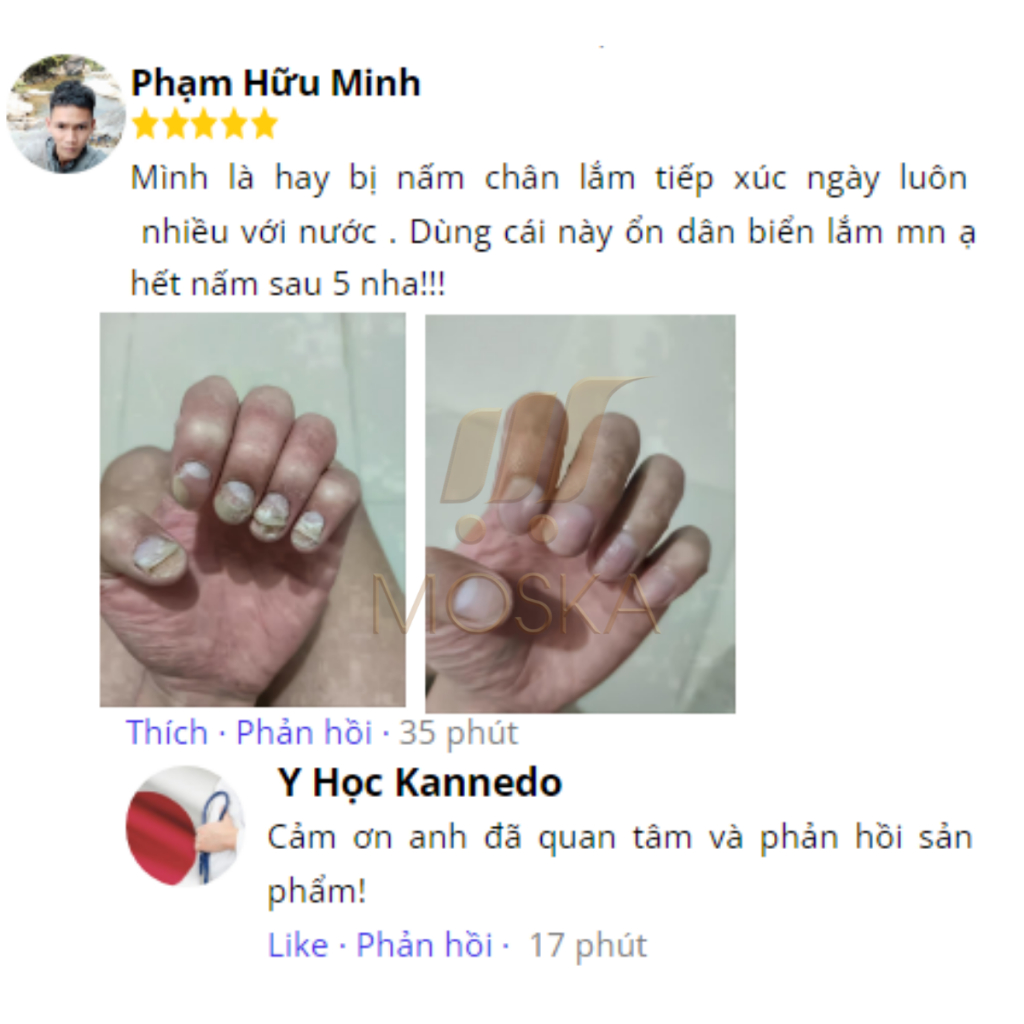 Tinh Chất Nấm Móng Tay Chân Kannedo Nhật Bản 30ML Giảm Nấm Móng, Hỗ Trợ Giảm Hư Móng, Dưỡng Móng Dày Và Khỏe| Moska shop