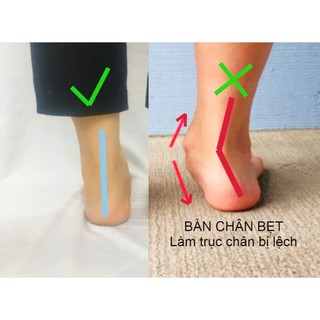 Dép Bít Mũi - BÀN CHÂN BẸT