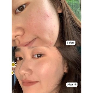 Kem che khuyết điểm Full Cover với độ che phủ cao