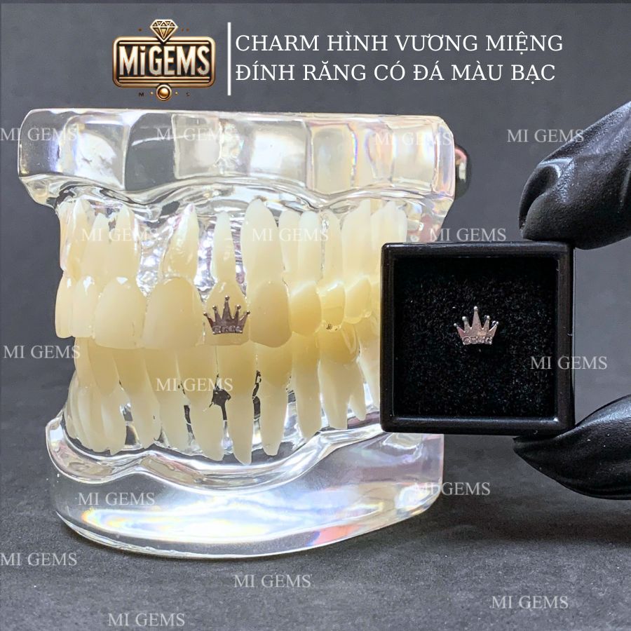 Charm hình vương miệng vua đính răng, gems đính đá răng Mi Gems