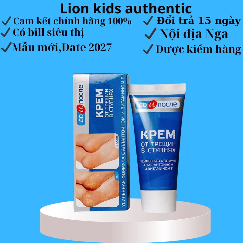 Kem Giảm Nứt Nẻ Gót Chân KPEM Nga 50ml tái tạo da và làm mềm da gót chân