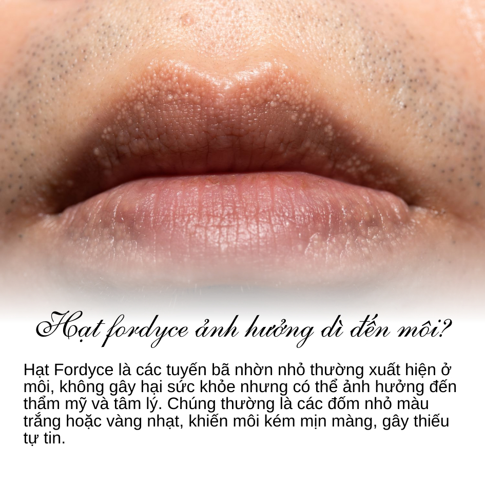 Kem Dưỡng Môi SUMIFUN Loại Bỏ Hạt Fordyce, Giảm Mụn Bã Nhờn, Dưỡng Ẩm, Phục Hồi Da & Giúp Môi Hồng Hào Tự Nhiên | BKINNO