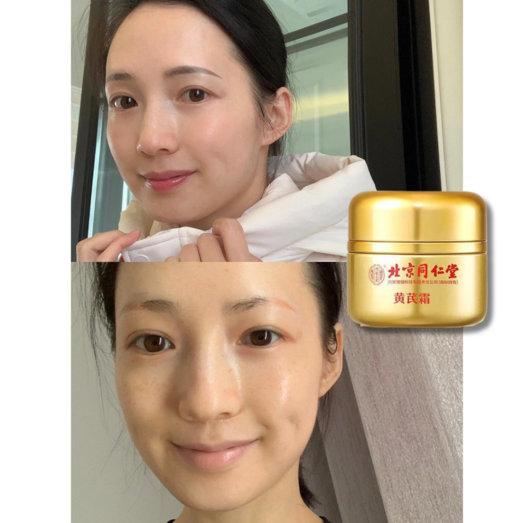 Kem dưỡng xương rồng 5in1 - Giúp trắng sáng da, cải thiện nếp nhăn, cho làn da săn chắc, giảm tàn nhang đồi mồi - QUINN