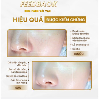 FACE TÁI TẠO COZY ( KEM NGÀY ) Dưỡng da trắng mịn , căng bóng hồng hào