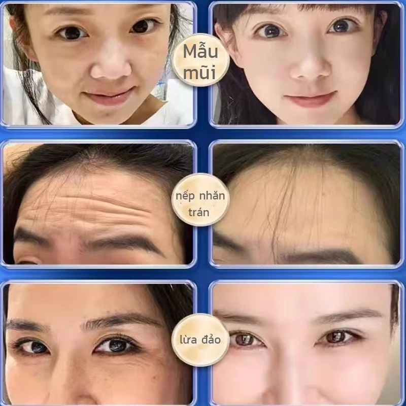 Kem xóa nhăn hoàng kỳ nhân sâm Huangqi - Kem xóa nhăn chống chảy xệ, bổ sung Collagen lấy lại độ đàn hồi cho da hộp 50g