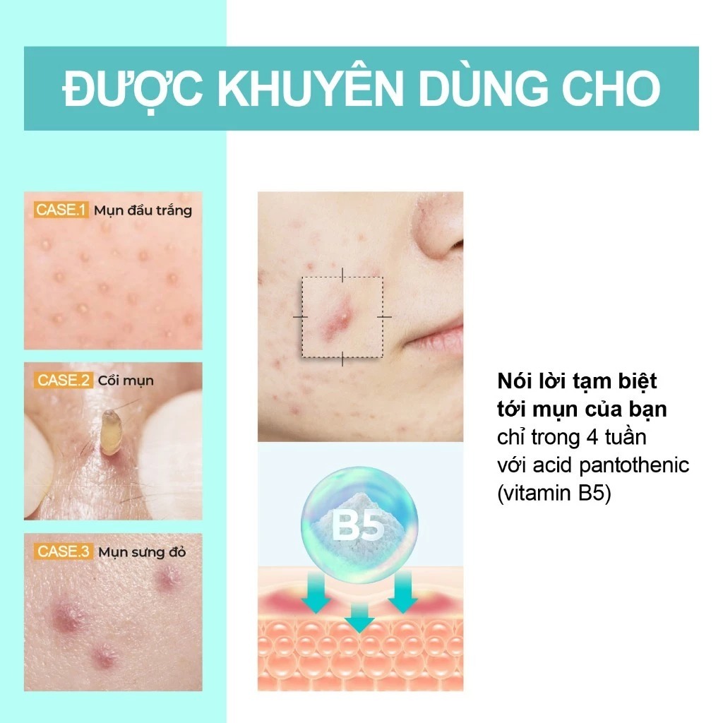 Kem làm dịu da hoạt tính Numbuzin Pantothenic B5 No.1 - 80ml fullbox | BigBuy360 - bigbuy360.vn