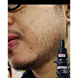 KÍCH MỌC RÂU X3