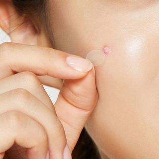 Miếng Dán Mụn Purederm 22 Miếng Giảm Sưng Viêm, Gom Cồi Nhanh, Mờ Thâm Hiệu Quả Cho Mọi Loại Da
