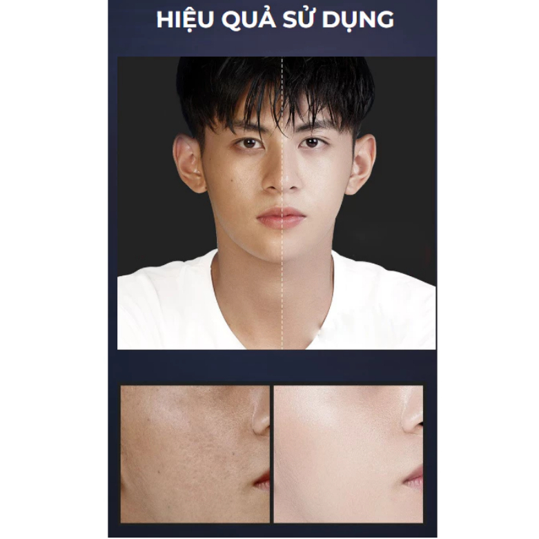 Sữa rửa mặt than tre BOTEX MEN - Sữa rửa mặt dành cho nam BOTEX tạo bọt nhẹ nhàng, sạch bã nhờn, dưỡng ẩm, kiềm dầu 80g