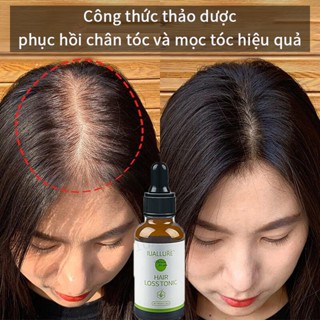 thuốc mọc tóc serum Giảm rụng tóc bảo vệ chân tóc kích thích mọc tóc nuôi dưỡng tóc hư tổn giúp tóc đen trở lại