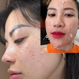 [Chính hãng].Chấm tàn nhang Yody Phương Anh