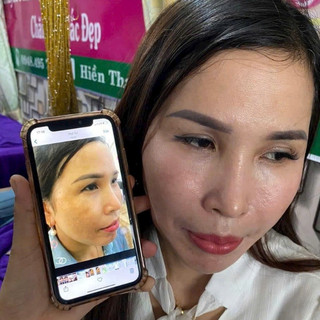 [Chính hãng].Chấm tàn nhang Yody Phương Anh