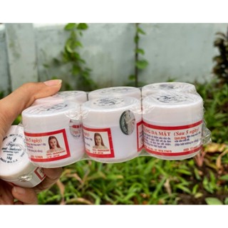  6 hộp kem Tigon trắng da mặt 18g Chính hãng 