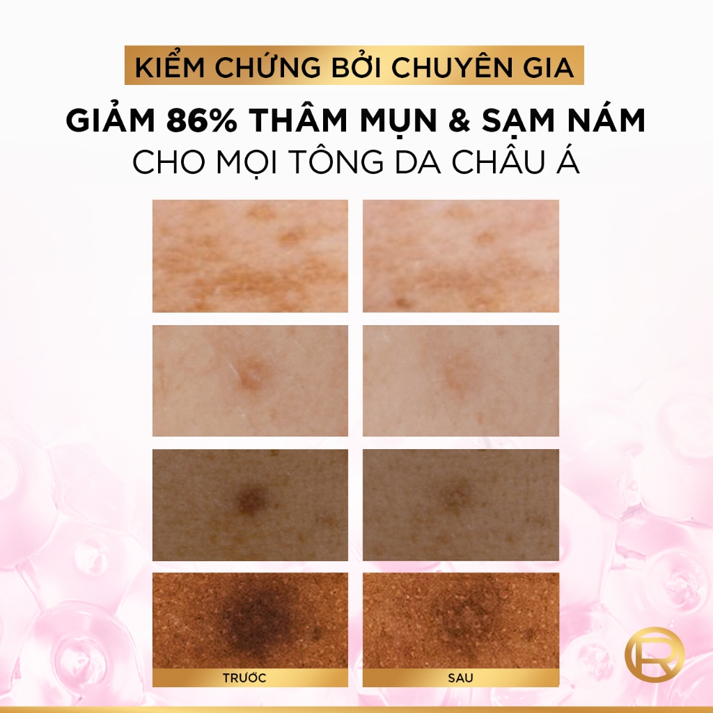 Serum Glycolic Melasyl 8% [Melasyl+Glycolic+Niacinamide] dưỡng sáng da, mờ thâm mụn & nám Loreal Paris 30ml | BigBuy360 - bigbuy360.vn