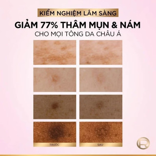 Serum Loreal Glycolic Melasyl 8% [Melasyl+Glycolic+Niacinamide] 30ml