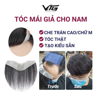 Tóc mái giả cho nam che hói chữ M, che trán cao, CÓ TẠO KIỂU, Sợi tóc thật, Đế silicon chân thực tự nhiên - Vua Tóc giả