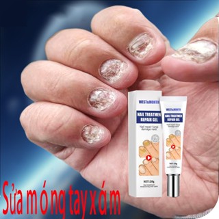  Kem phục hồi móng Móng kháng khuẩn chân loại nấm móng gãy móng chống Kem giúp hết nấm làm thối móng tay móng chân 