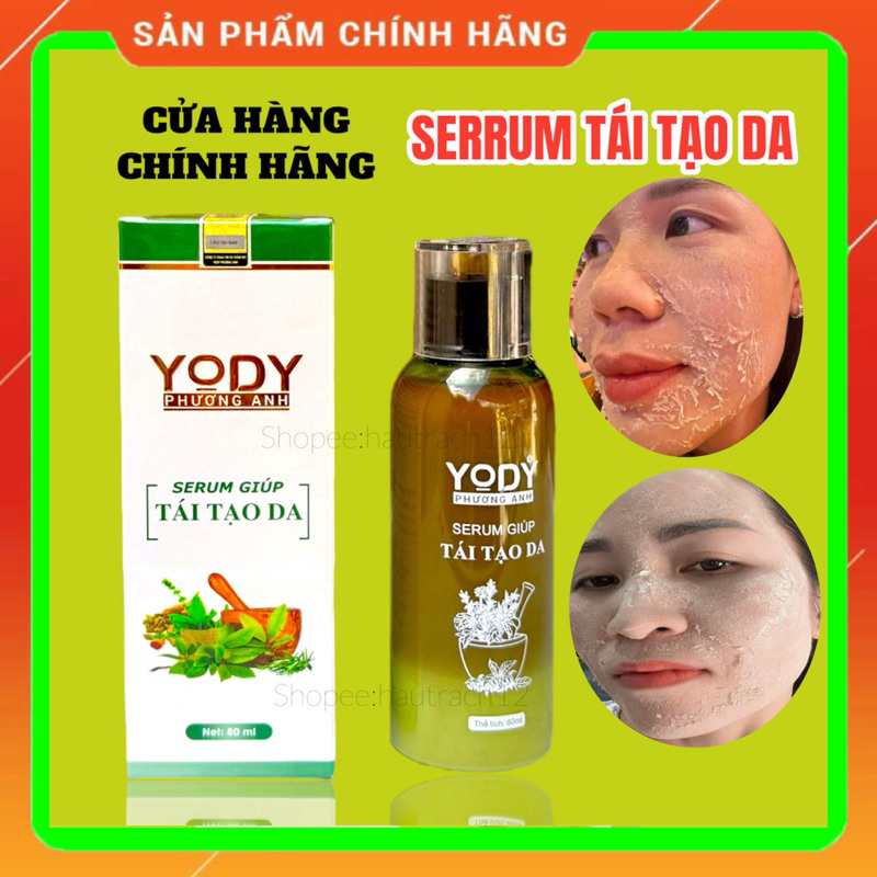 𝐓𝐚́𝐢 𝐓𝐚̣𝐨 𝐃𝐚 𝐘𝐨𝐝𝐲 𝐏𝐡𝐮̛𝐨̛𝐧𝐠 𝐀𝐧𝐡 𝟖𝟎𝐦𝐥 𝐂𝐡𝐢́𝐧𝐡 𝐇𝐚̃𝐧𝐠