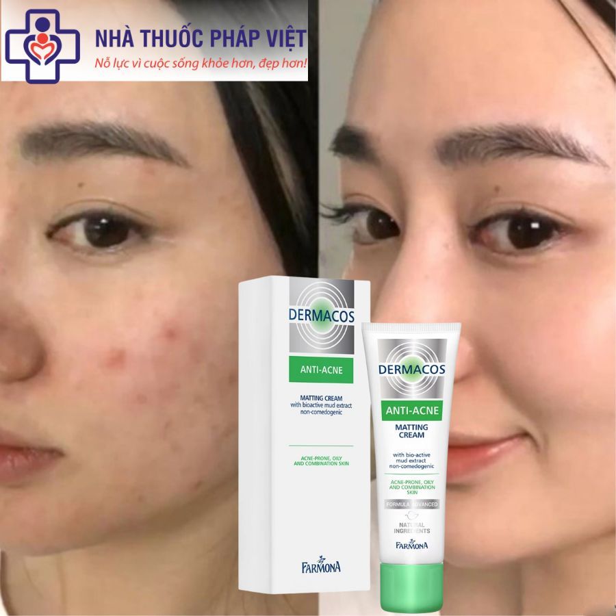 Kem Dưỡng Giảm Bóng Nhờn Dermacos Farmona Dermacos Anti Acne Matting Cream 50ml