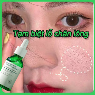 Serum trắng da serum se khít lỗ chân lông 30ml se khít lỗ chân lông mụn đầu đen vết mụn dưỡng ẩm