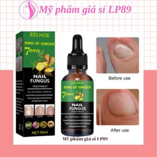  Serum Nấm Móng Tay Chân Hết Sạch Nấm Bọng Móng Hư Khoé Nước Ăn Tay Chân Dưỡng Cứng Móng Eelhoe 