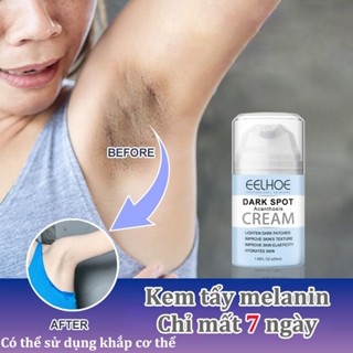 Kem làm trắng da Kem Thâm Nách kem làm trắng vùng kín bikini 50g Nuôi dưỡng và tái tạo da trắng sáng