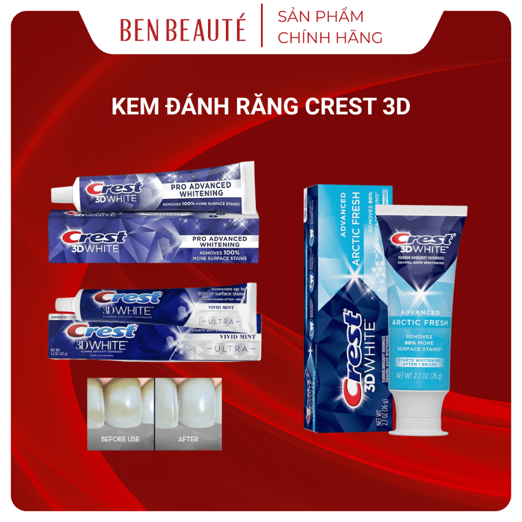 Kem Đánh Răng Crest 3D White Advanced Whitening 147gr