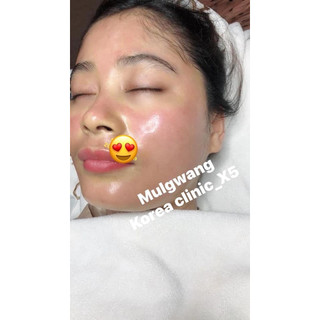 Tinh chất căng bóng da Mulwang x5 Hàn Quốc dùng lăn kim, phi kim Spa, TMV