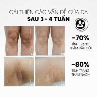 Sữa Dưỡng Thể Sáng Da Mờ Thâm 4% Alpha Arbutin-3% Niacinamide MD CARE Brightening Booster Body Lotion 200ml