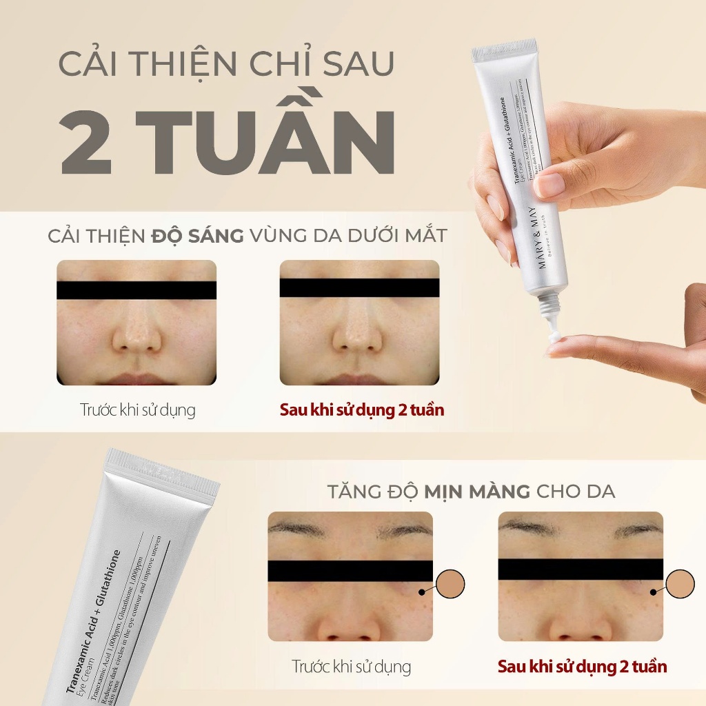 Set Kem mắt cải thiện vùng da quanh mắt Mary&May Glutathione Eye Cream (30g+12gx2) | BigBuy360 - bigbuy360.vn